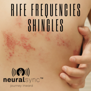 Rife frequencies natural cure for shingles by NeuralSync